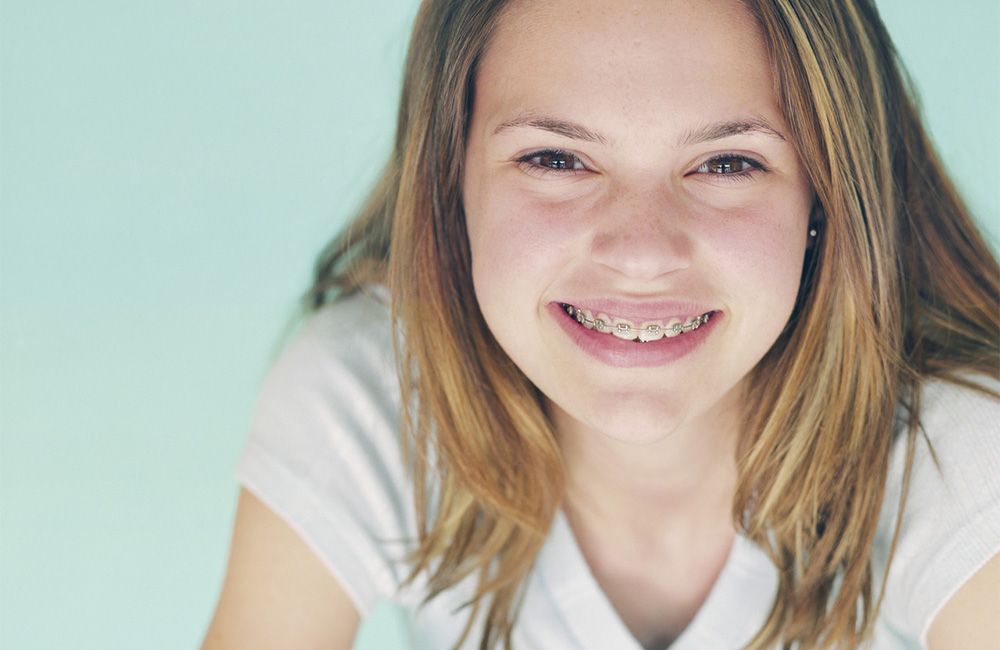 Cute young girl smiling with braces